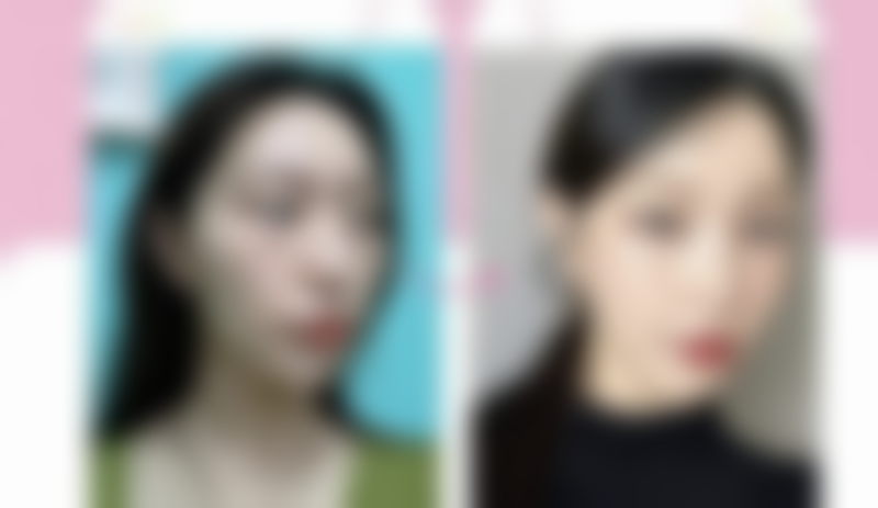 北京华夏医美医疗美容诊所口碑如何？