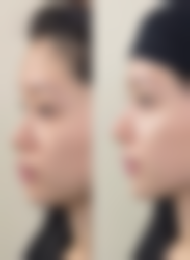 北京华夏医美医疗美容诊所医院技术好不好？