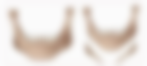 医美隆胸一般什么价？受方法、地域等因素影响，不同医院价格大不同