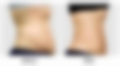 治疗注意事项与护理