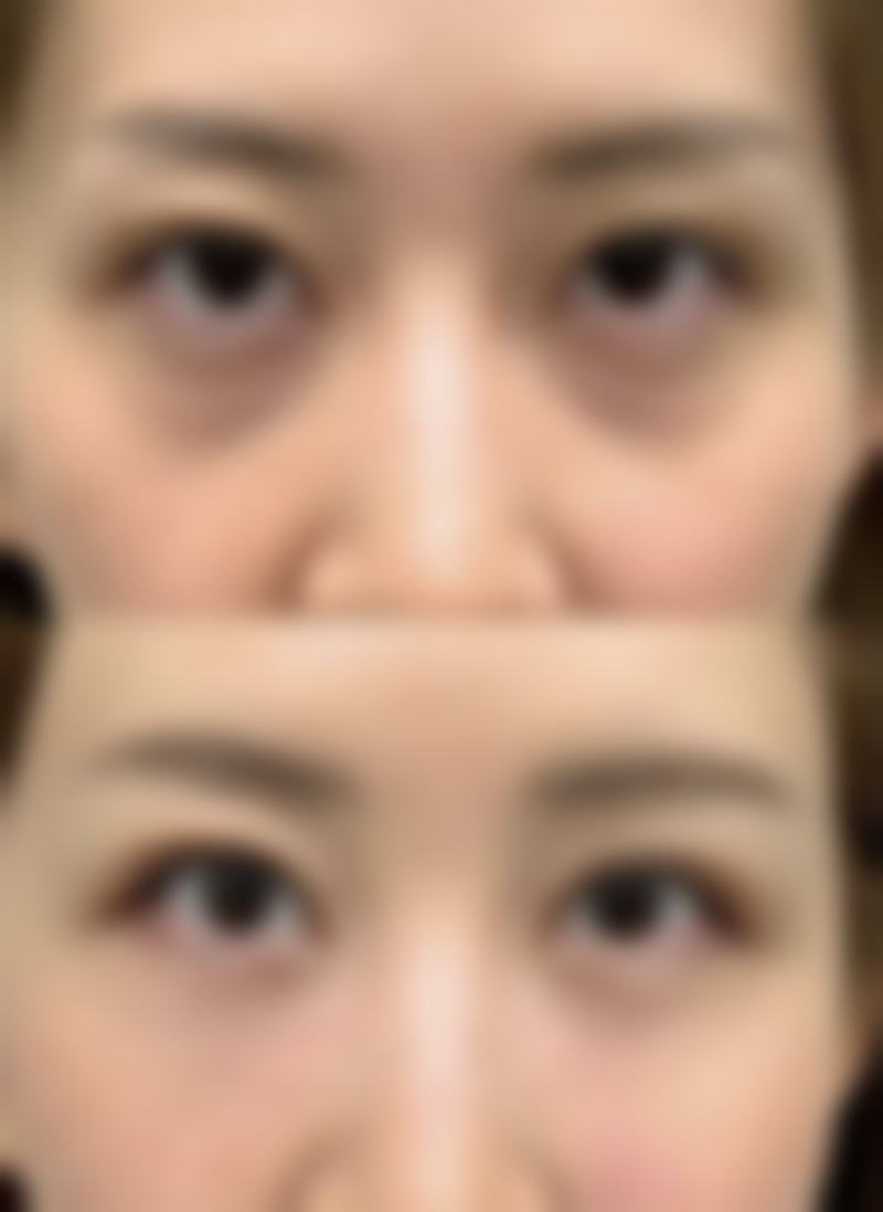 韩国劳雷尔医院许峻赫医生技术好不好？