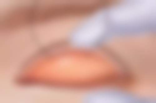 国内人民解放军北部战区总医院（整形美容中 心）口碑如何？