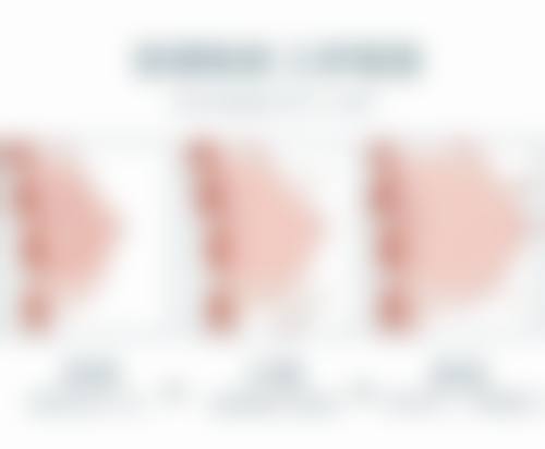 影响双眼皮疤痕修复的因素