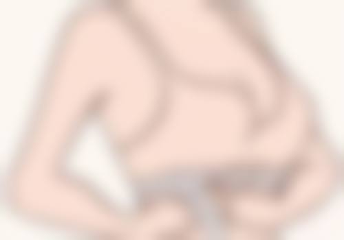 假体隆胸的修复阶段