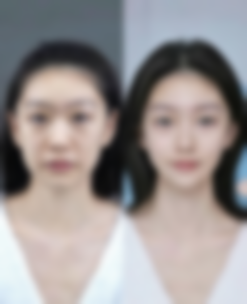 佛山幻都荣恩整形医院口碑如何？