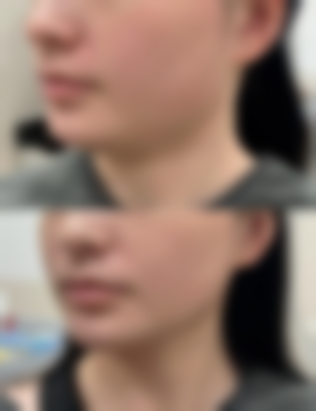 成都优莱医疗美容门诊部收费标准参考