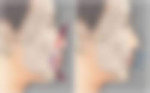 总结——瑞丽伊姿整形医院怎么样？