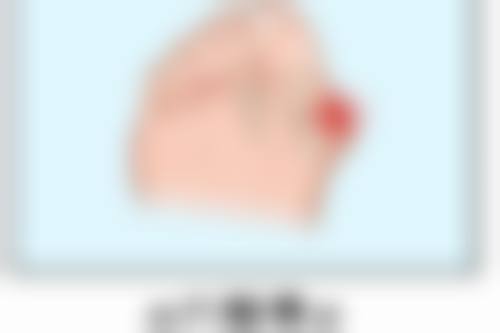 抽脂让屁股变小的成效如何