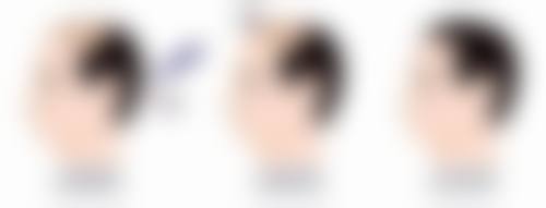 总结——眉山皮肤病医院皮肤美容科郑雪蕾医生怎么样?