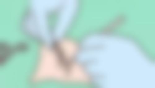 韩国shinyu整形外科医院技术好不好？