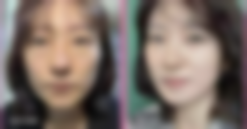 牡丹江人民医院整形美容科原茵医生技术好不好？