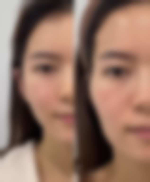 做好术后清洁工作