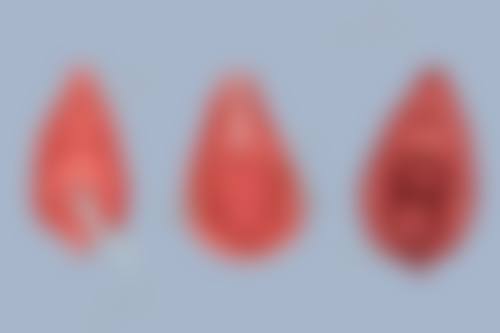 产品和手术该怎么选