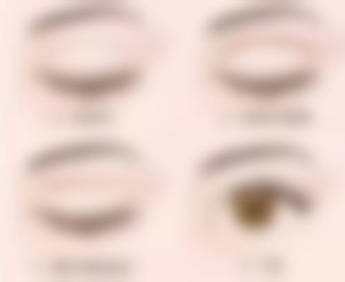 除皱做什么效果好？肉毒素、填充剂、激光等多种方式各有优势任你选