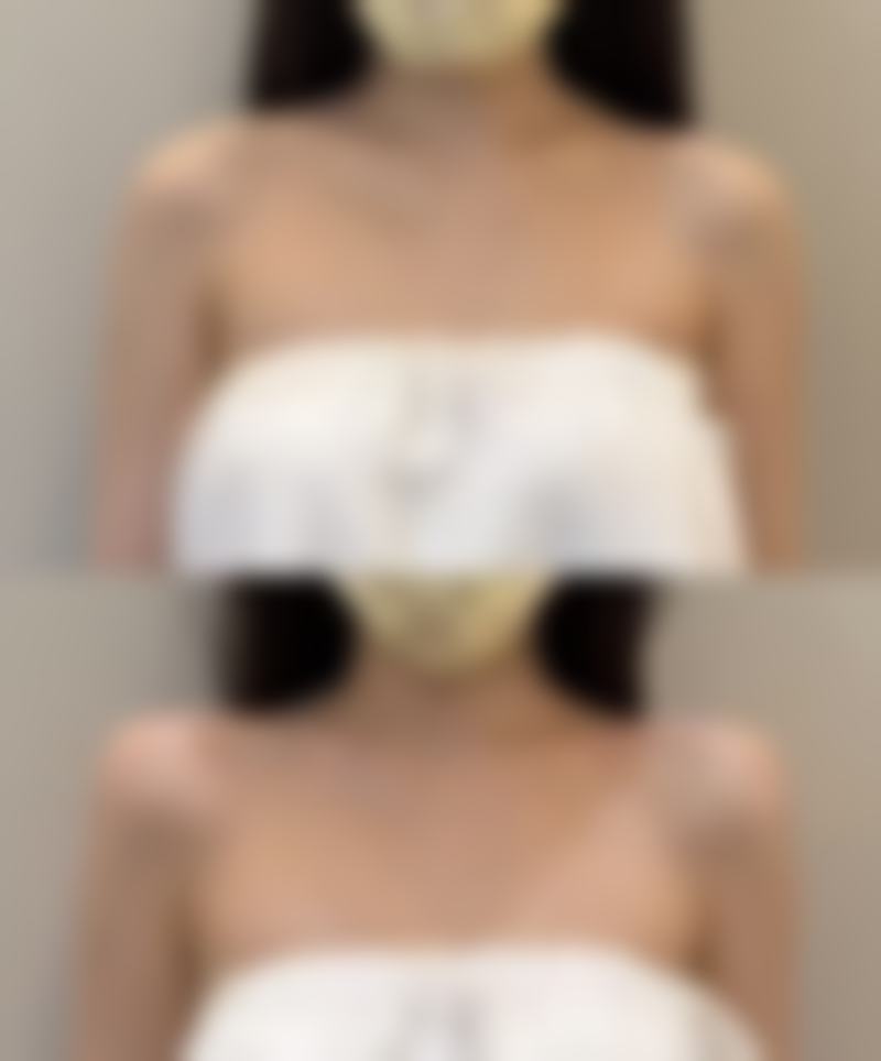 术后修复和注意事项