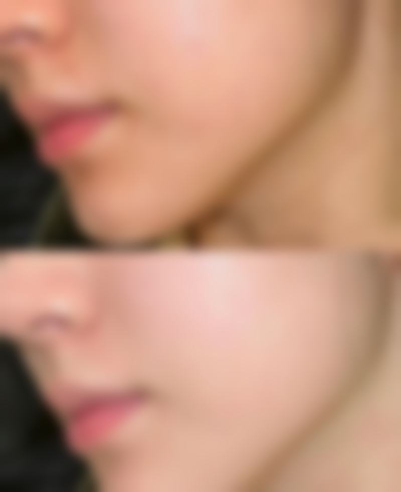 治疗周期和次数