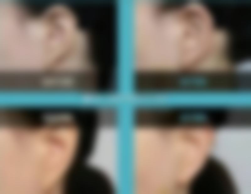 台中亞欣醫美整形診所口碑如何？