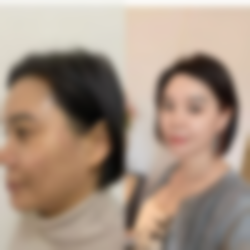 苏州悦享美整形医院口碑如何？