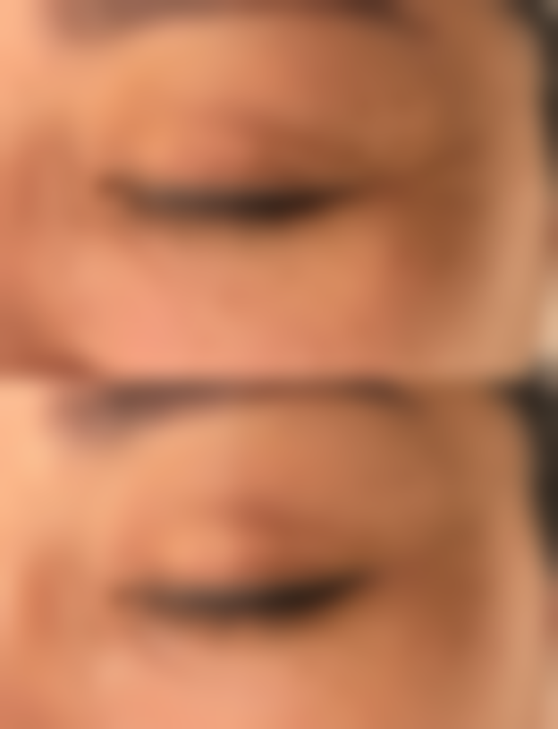 西安杏仁医疗美容门诊部硬件设备精良！