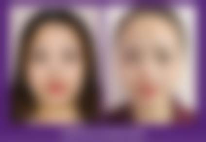 长沙雅美医美做眶周年轻化4800元起，姚江华医生助力多技术联合打造年轻眼周