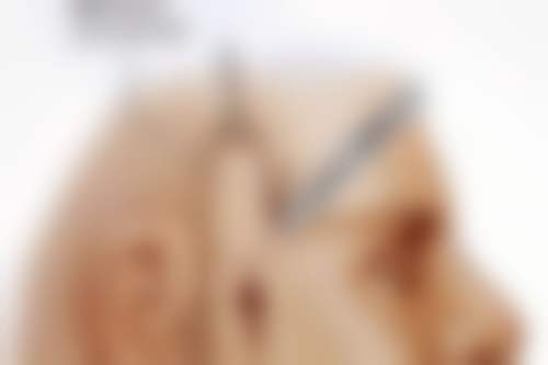 影响感染留下的疤痕修复成效的因素