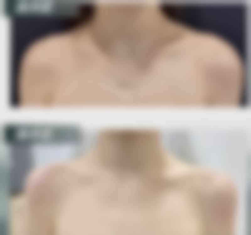 鸡西Dr.W王医生整形医院口碑如何？