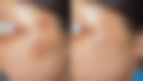 达州爱尔博视医院周奇志医生挂号预约攻略