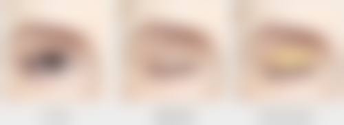 脸上有凹陷疤痕能修复吗？多种方法及长沙核美丽门诊助你告别凹陷重拾美丽
