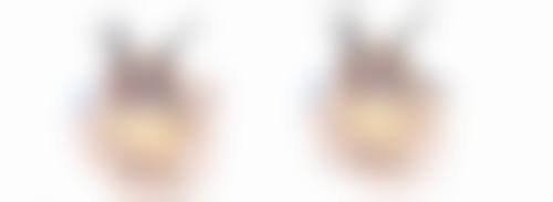 割双眼皮割完就可以睁眼吗 不同术式睁眼情况及各阶段睁眼建议有哪些