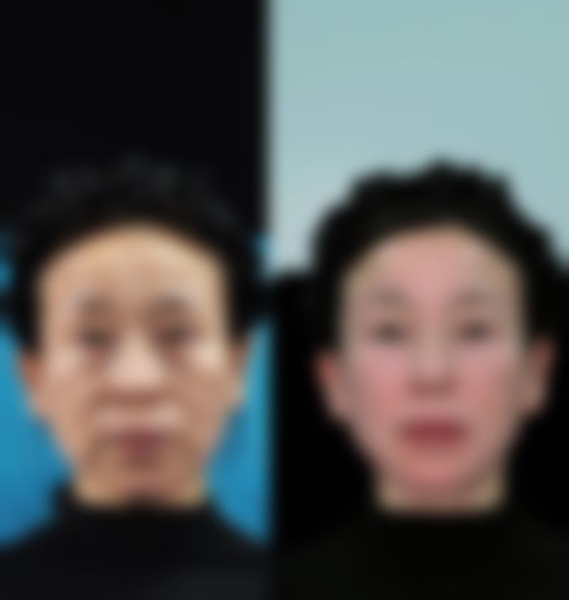 睁眼对修复的好处