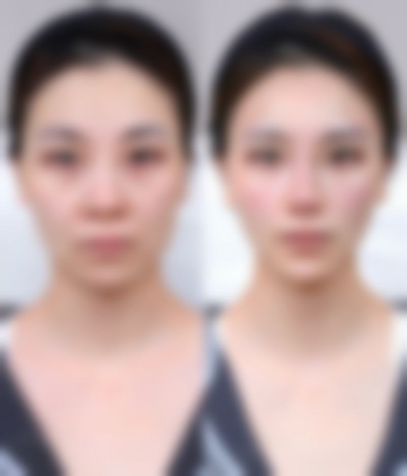 白城于晶整形美容门诊部口碑如何？