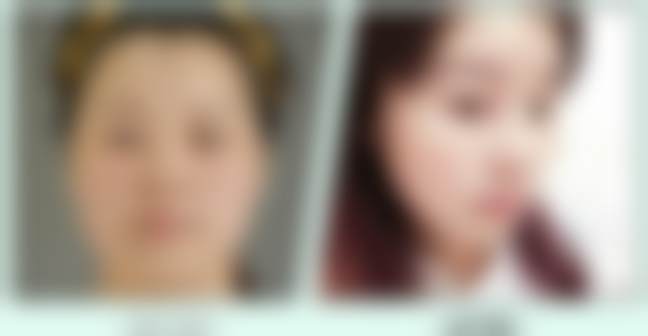 北京禾美嘉医疗美容门诊部开展项目及价格