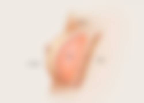 总结——武汉领秀医疗美容门诊部陈琳森医生怎么样？