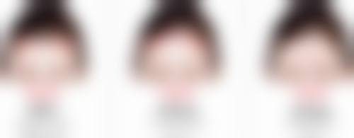长沙中南大学湘雅医院左琛琛医生技术好不好？