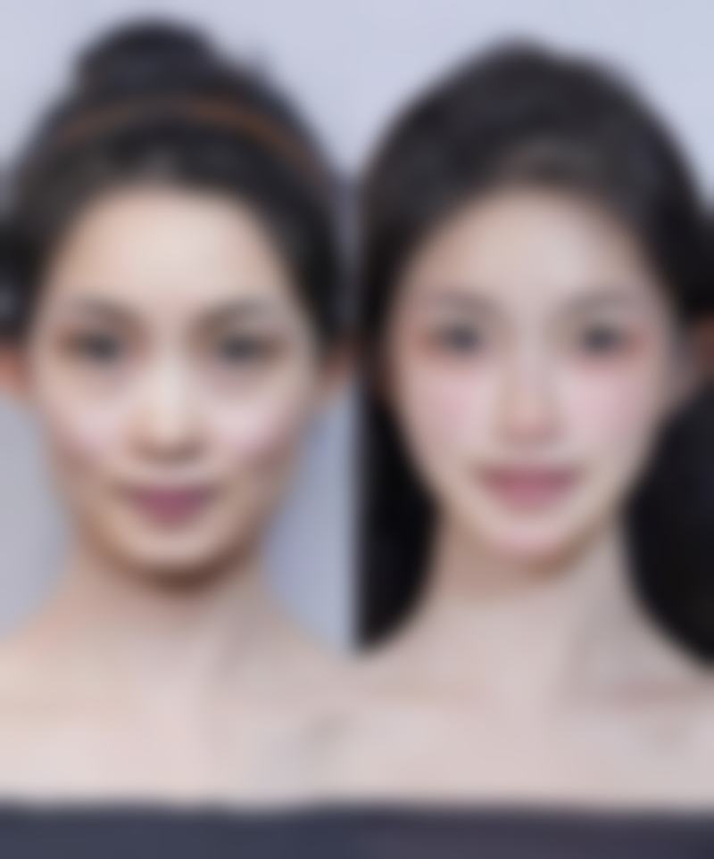 总结——成都紫藤花语医疗美容诊所怎么样？
