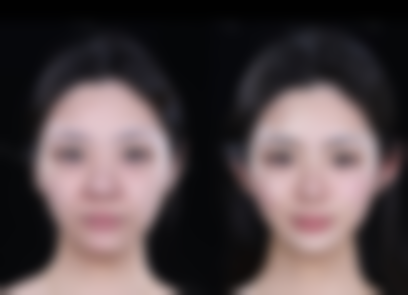 南京秦淮美好尉来医疗美容诊所收费标准参考