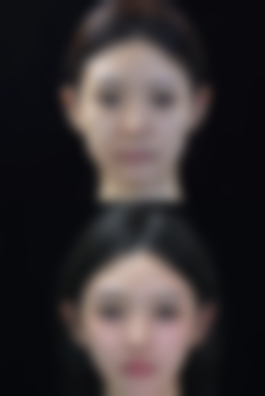 南京秦淮美好尉来医疗美容诊所医院技术好不好？