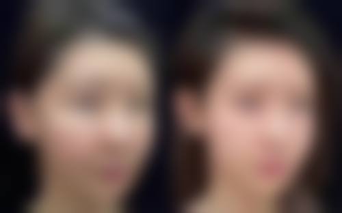 深圳弘美医疗美容机构电话号码及预约方法