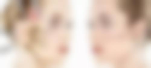 南平仁爱医院美容整形科医院技术好不好？
