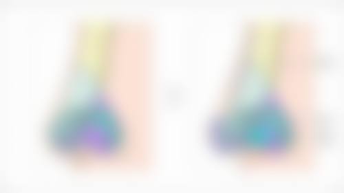 蚊虫叮咬会造成双眼皮处红肿痒痒