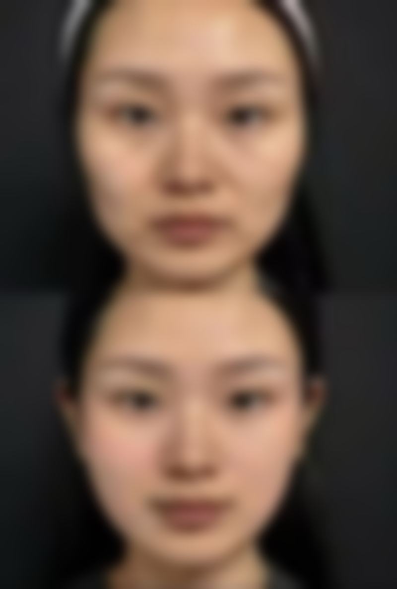 成都高新维星颜整形医院口碑如何？