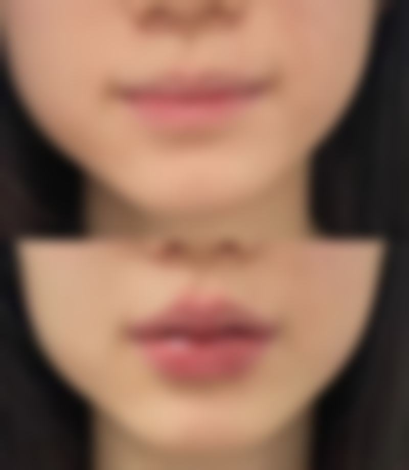 成都高新维星颜整形医院医院技术好不好？
