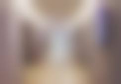 福州台江海峡美容医院吴淑芬属于什么档次？从眼部面部整形成果看她在业内中高级水平魅力！ 
