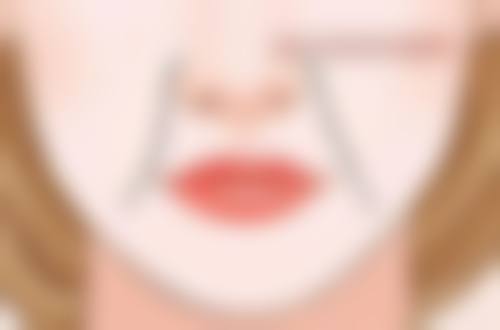 喂奶期间做双眼皮手术的替代方案