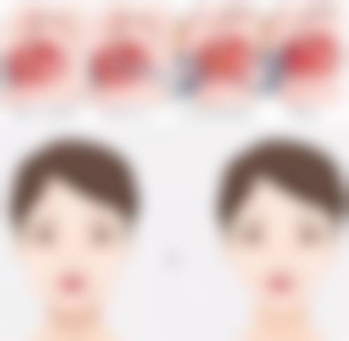 佛山典燃医疗美容诊所徐超然医生技术好不好？