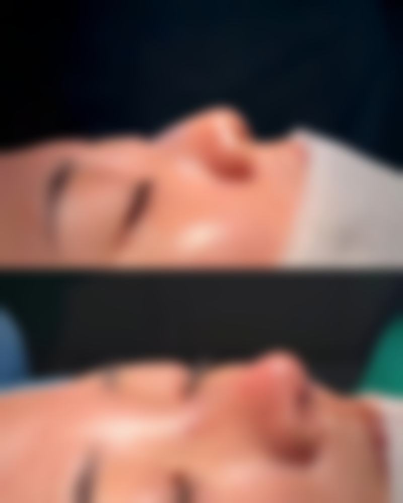 总结——烟台瑞雅韩整形医院怎么样？