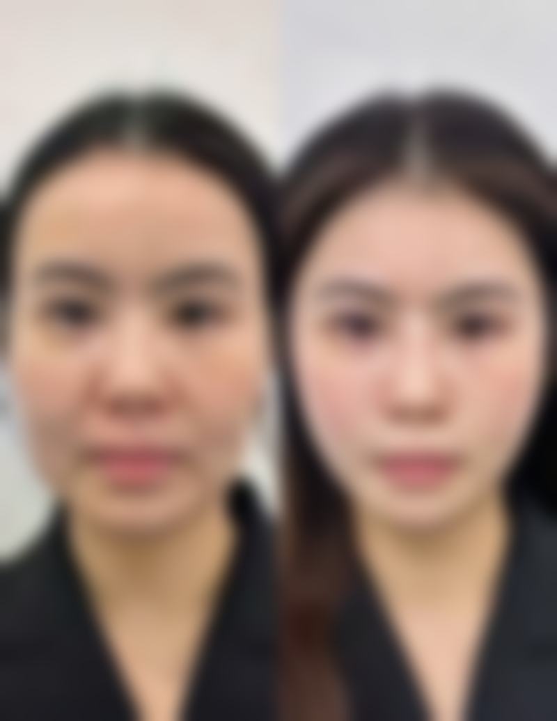 总结——大连光普整形医院怎么样？