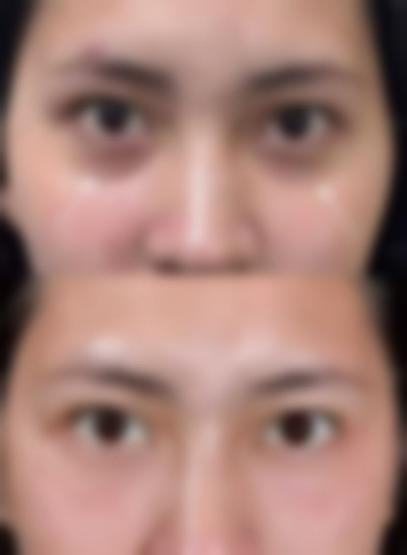 杭州丽兹医疗美容诊所口碑如何?