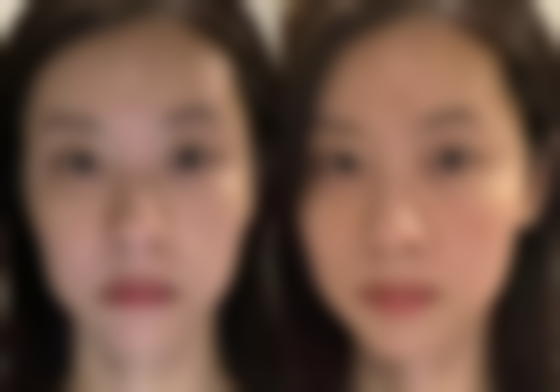 南宁思瑞医疗美容诊所医院技术好不好?