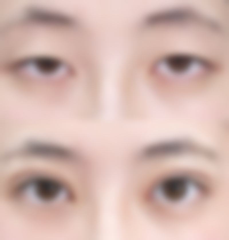 韩国SKY整形外科医院技术好不好?